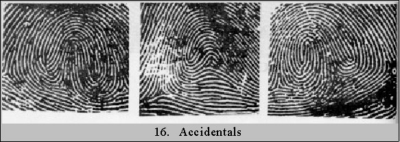 accidentals